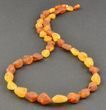 Raw Amber Necklace Made of Precious Healing Baltic Amber