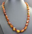 Cognac Amber Healing Necklace Made of Bean Shape Amber 