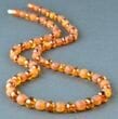 Amber Healing Necklace Made of Raw and Polished Cognac Amber