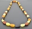 Raw Amber Healing Necklace Made of Bean Shape Amber Beads