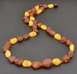 Raw Amber Healing Necklace Made of Cognac, Honey Baltic Amber