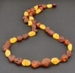 Raw Amber Healing Necklace Made of Precious Baltic Amber