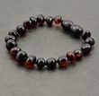 Amber Bracelet Anklet for Children Made of Cherry Amber