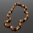 Amber Healing Necklace Made of Three Color Baroque Amber Beads 