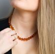 Amber Healing Necklace Made of Baroque Cognac Baltic Amber