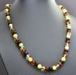 Amber Healing Necklace Made of Four Color Baroque Baltic Amber