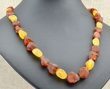 Raw Amber Healing Necklace Made of Cognac, Honey Baltic Amber