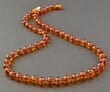 Amber Healing Necklace Made of Baroque Cognac Baltic Amber