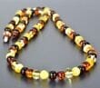 Amber Healing Necklace Made of Four Color Baroque Baltic Amber