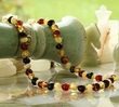 Amber Healing Necklace Made of Four Color Baroque Amber Beads