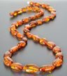 Cognac Amber Healing Necklace Made of Bean Shape Amber 